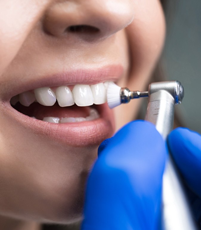 A tooth being polished