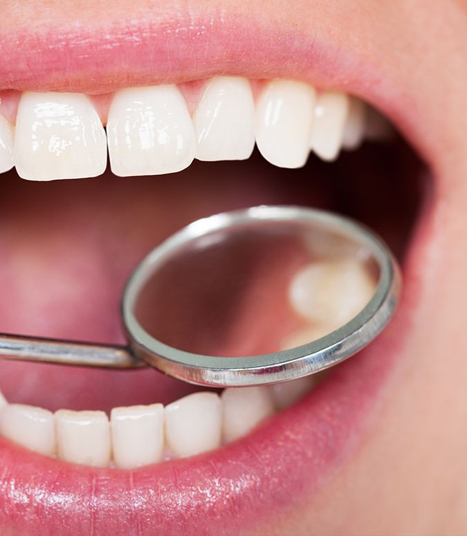 Closeup of smile after tooth-colored filling placement