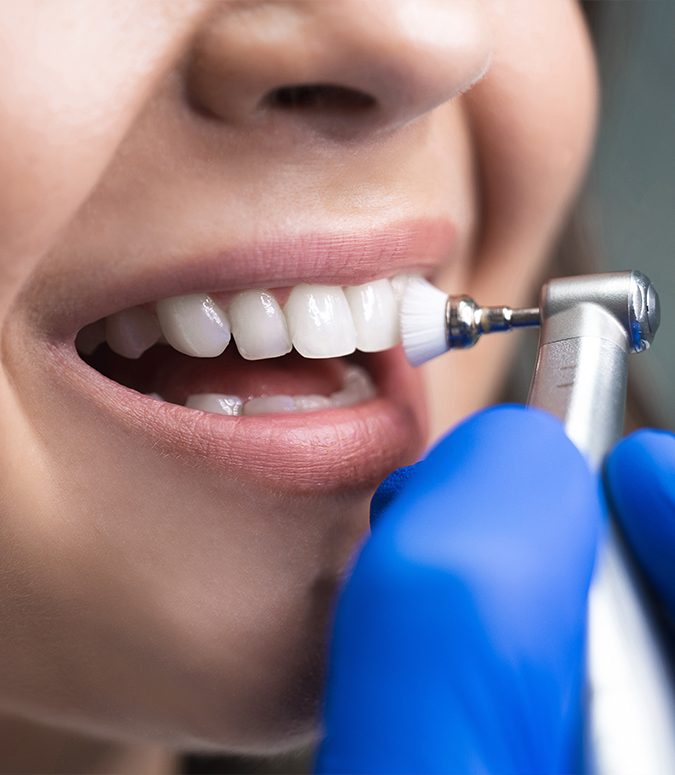 Patient receiving fluoride treatment