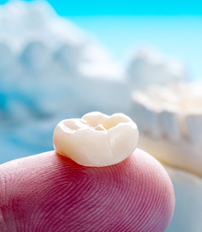 Closeup of dental crown in Englewood on fingertip