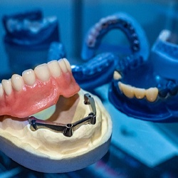 implant dentures in Englewood