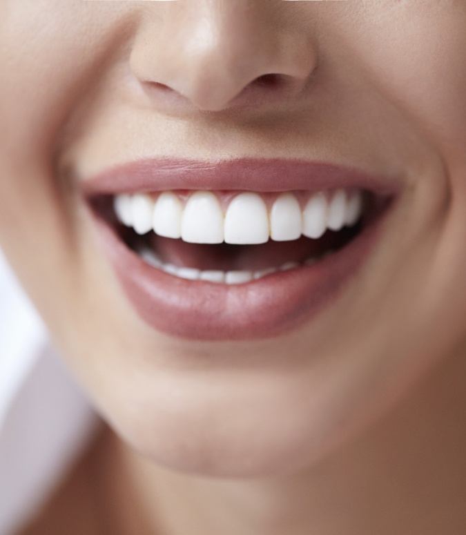 Closeup of flawless smile after dental implant tooth replacement