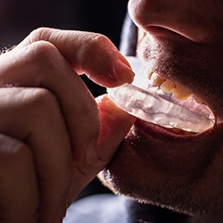 A man placing a mouthguard in his mouth 