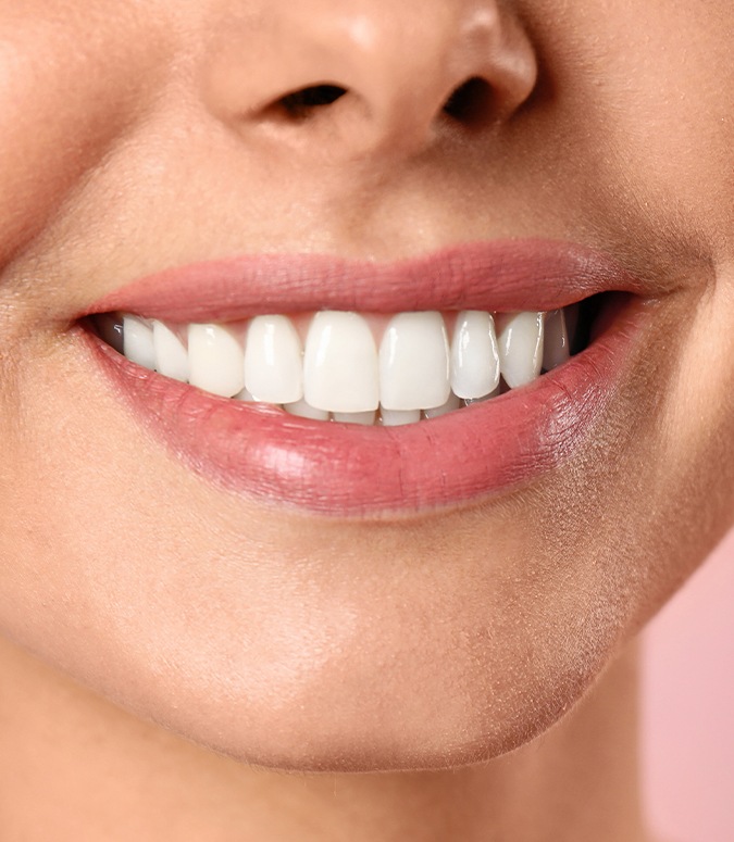 Closeup of smile after dental bonding