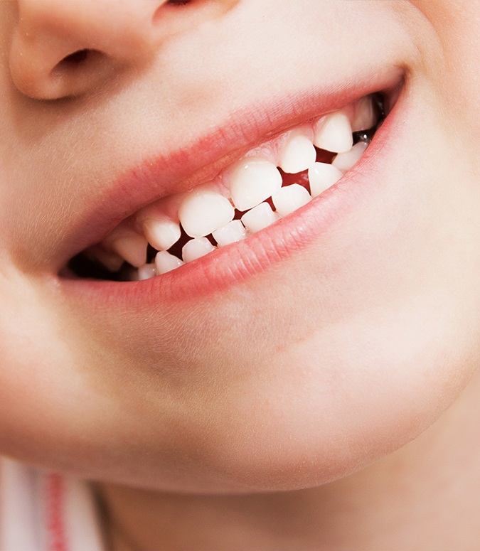 Child with healthy smile after dental sealants