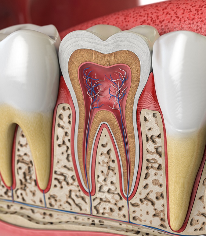 Animated inside of a tooth in need of root canal therapy